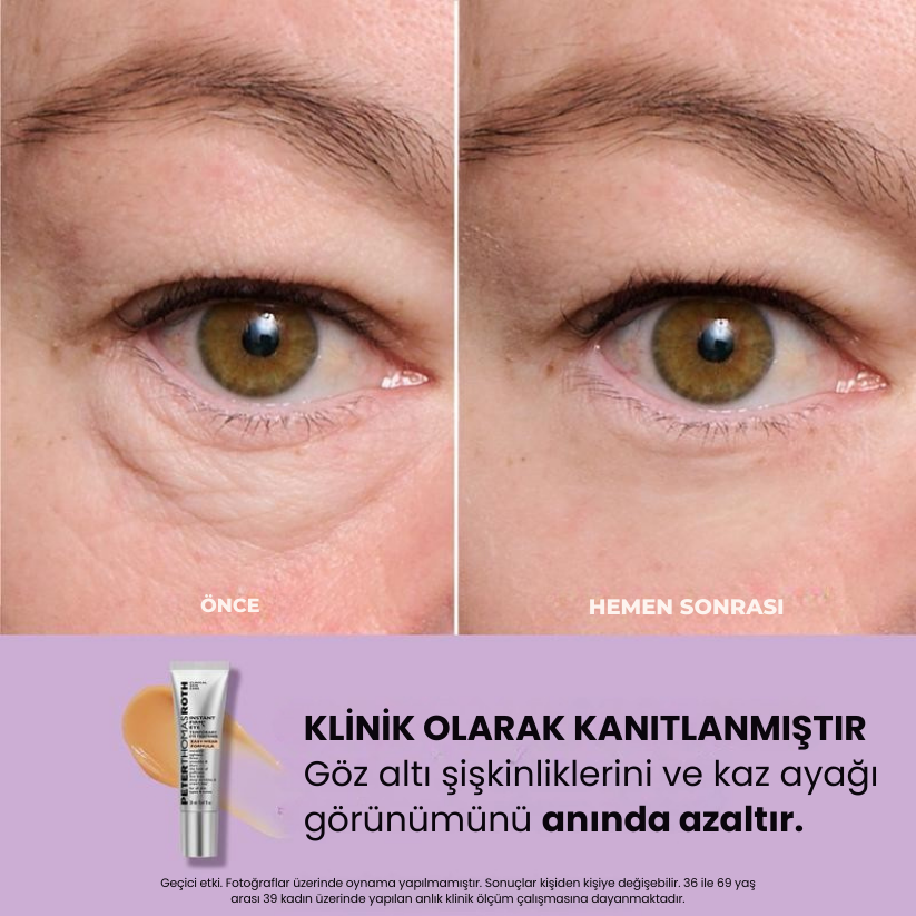 Lexorita™ Anında Göz Sıkılaştırıcı – Dakikalar İçinde Genç Görün, Etkisi Tüm Gün Sürer