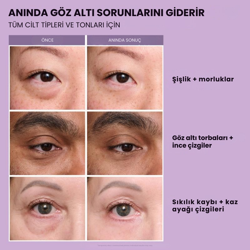 Lexorita™ Anında Göz Sıkılaştırıcı – Dakikalar İçinde Genç Görün, Etkisi Tüm Gün Sürer