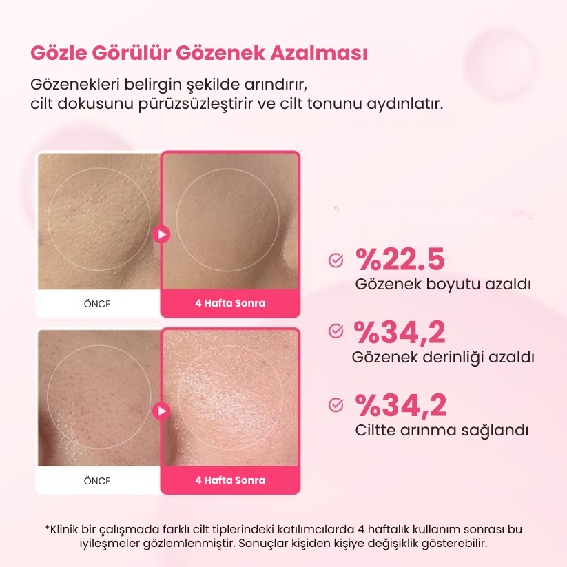 Gözenek ve Leke Karşıtı İkili – Gözenekleri Sıkılaştırır, Lekeleri Azaltır, Işıltılı Bir Cilt Sunar