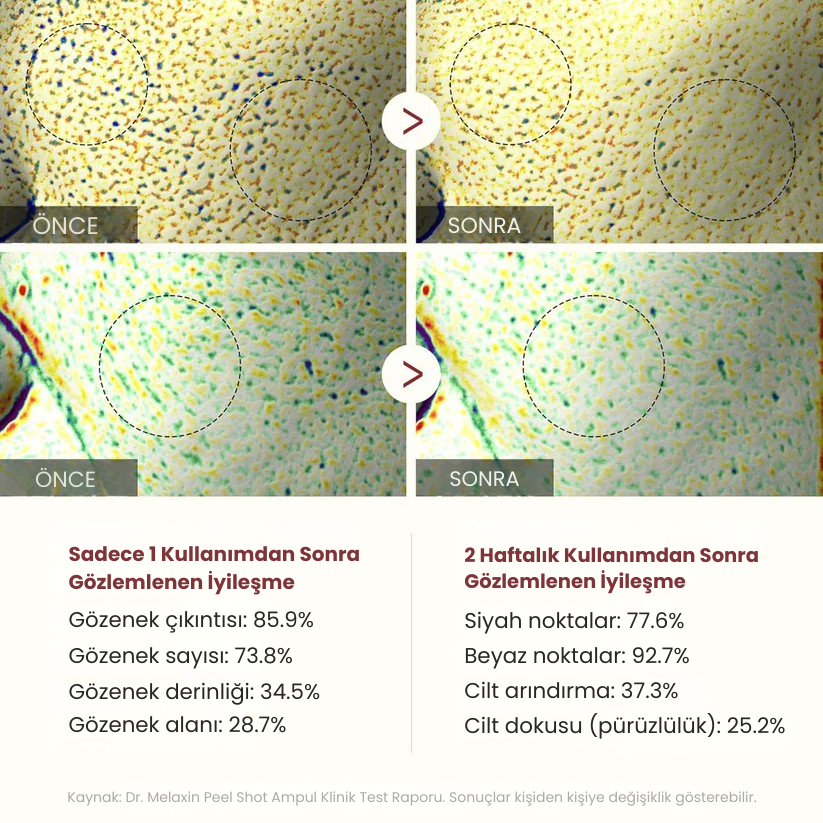 Eksfoliasyon Pirinç Peeling İkilisi – Ölü Deriyi Anında Temizler, Pürüzsüz ve Işıltılı Cilt Sunar