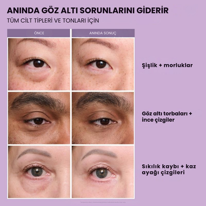 Lexorita™ Anında Göz Sıkılaştırıcı – Dakikalar İçinde Genç Görün, Etkisi Tüm Gün Sürer